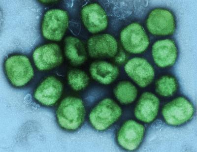 Colorized microscopic image of monkeypox virus.